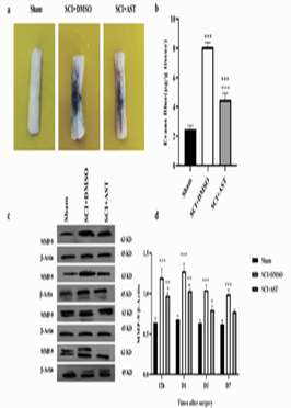 Astaxanthin ameliorates spinal cord edema and astrocyte activation via suppression of HMGB1/TLR4/NF‑κB signaling pathway in a ra
